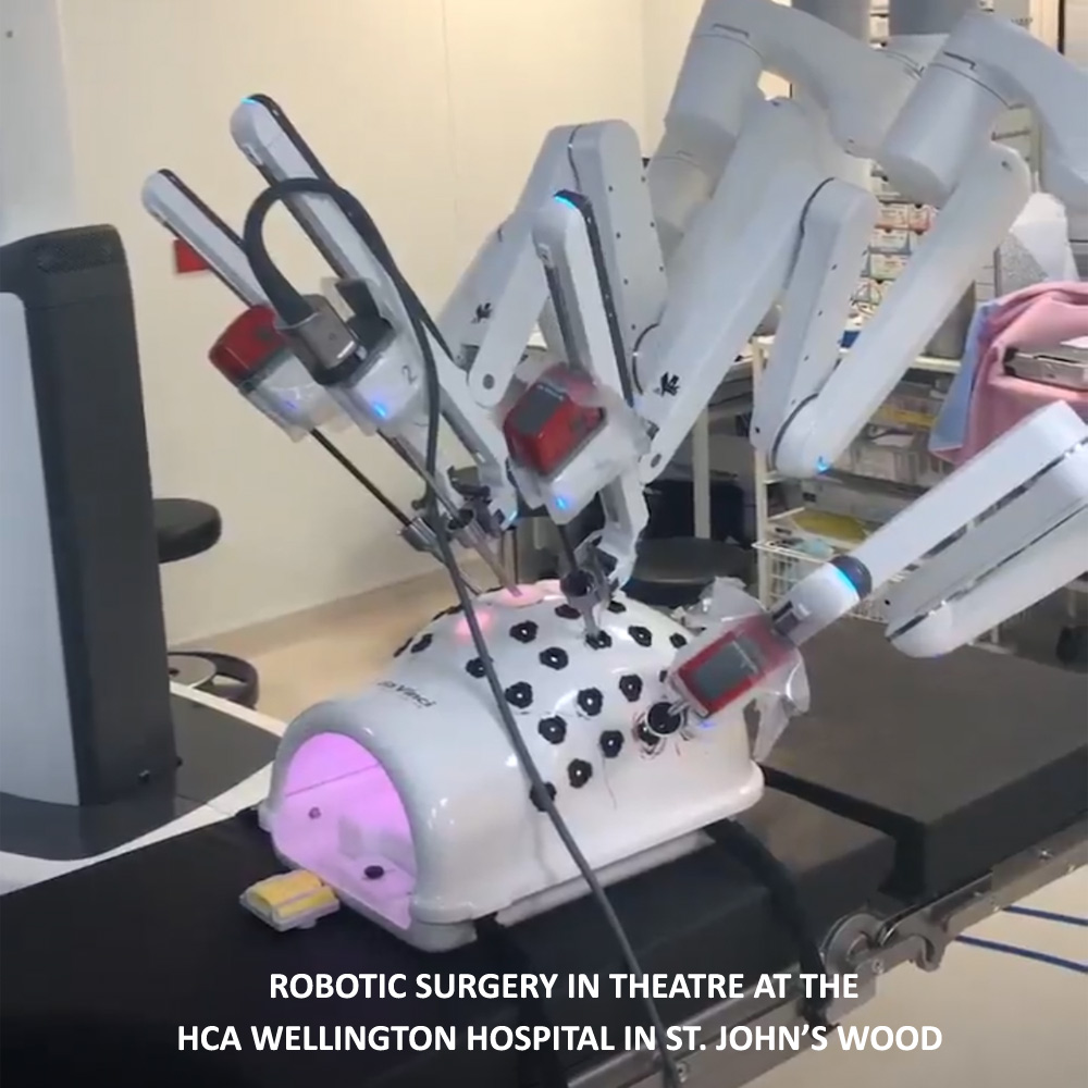 Robotic Surgery